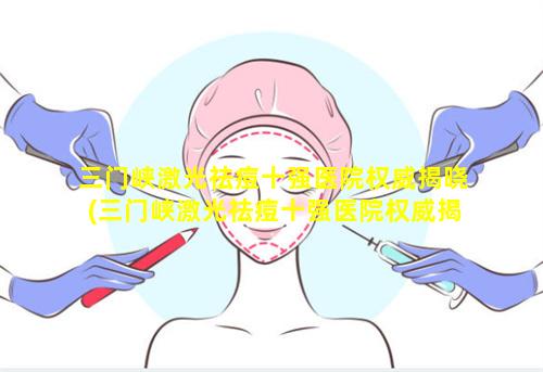 三门峡激光祛痘十强医院权威揭晓(三门峡激光祛痘十强医院权威揭晓医生是 🐶 谁)